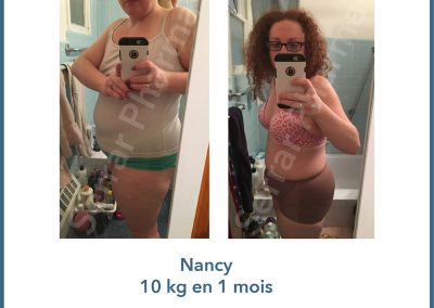 Clinique minceur avant et après 10 - Hammam Zinabelle