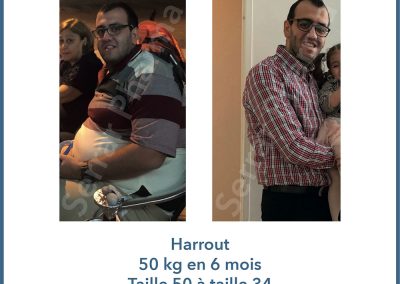 Clinique minceur avant et après 4 - Hammam Zinabelle