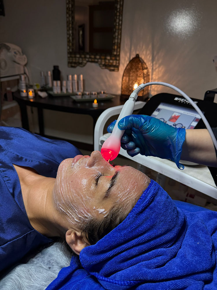 Soins Médico-Esthétique - Hammam ZinaBelle à Montréal